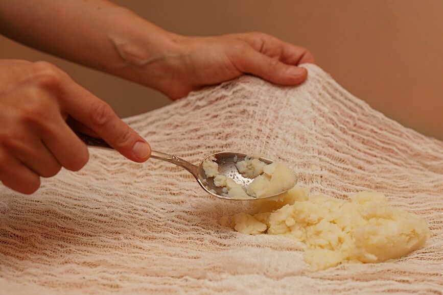 Honey and Potato Compress
