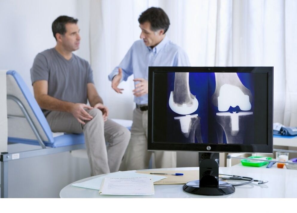 Knee articulation arthrosis in image x -ray